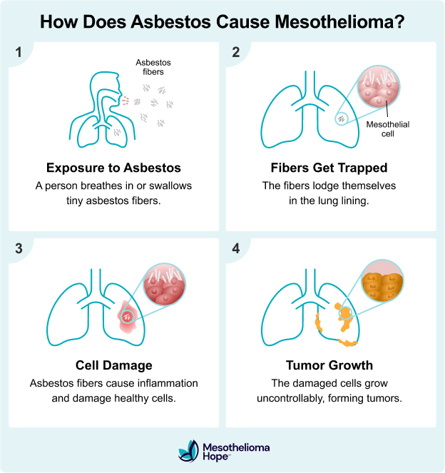 mesothelioma-causes